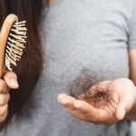 Weight loss injections cause higher risk of hair loss