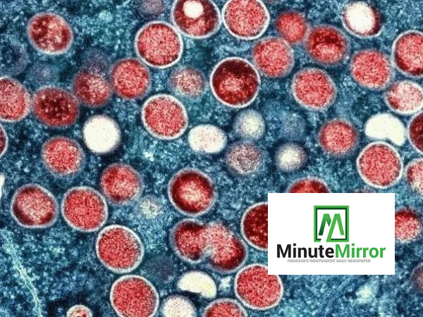 Sindh records 93 confirmed Mpox cases, 11 deaths t...